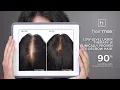 Hairmax LaserBand 41 ComfortFlex w/ Free Haircare Bundle - Video 5 of 1