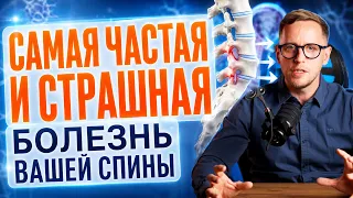 Заклинивает спину и боль при наклоне: НЕСТАБИЛЬНОСТЬ ПОЗВОНОЧНИКА. Лечение без операции, упражнения
