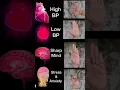 Download Lagu Powerful Mudras #yoga #mudra #high #low #blood #pressure #sharp #mind #stress #anxiety #ytshorts #yt