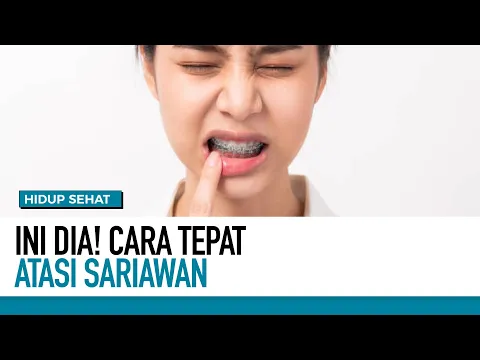 Cara Atasi Sariawan Secara Alami dan Mudah!