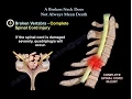 Cervical spine fracture neck fracture - Everything You Need To Know