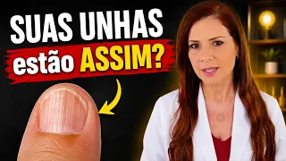 CUIDADO! UNHAS ASSIM? RISCO PARA A SAÚDE!