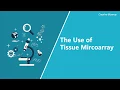 The Use of tissue array