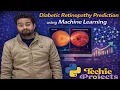 Diabetic Retinopathy Detection using Deep Learning IEEE Projects for Computer Science