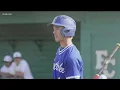 Vigil held for beloved Chula Vista athlete former Little League World Series star