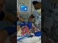 Conjoined twins born at UC Davis Children s Hospital