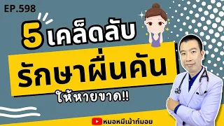 ทำไมการอาบน้ำด้วยน้ำอุ่นจัดถึงทำให้ผื่นคันแย่ลง?