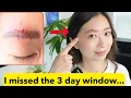 Download Lagu The Story of How I Came Close to Going Blind (and why younger people are suffering this)