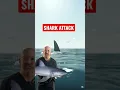 Download Lagu 🦈 ATTACK Leg Amputee #shorts