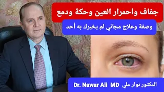 جفاف العين واحمرار وحكة ودمع   حساسية العين    وصفة طبيعية وحلول مجانية مفيدة جدا    دندنها