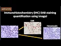 Immunohistochemistry IHC DAB staining quantification using ImageJ