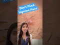 Don t Pluck Ingrown Hairs