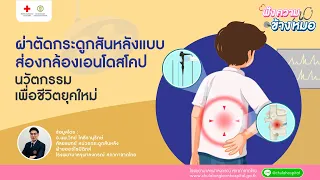 การผ่าตัดกระดูกสันหลังแบบส่องกล้องเอ็นโดสโคปเหมาะกับผู้ป่วยกลุ่มใดบ้าง