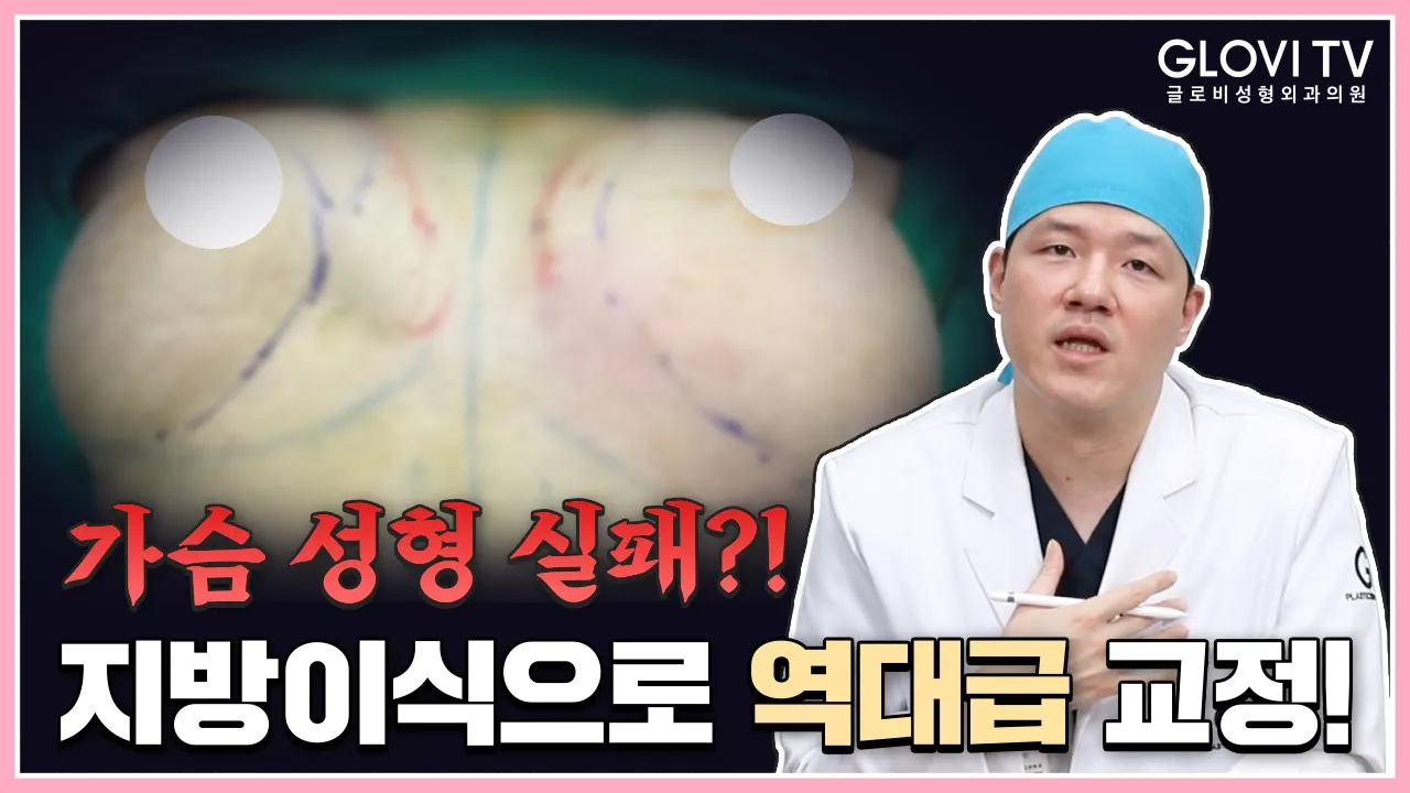 가슴 성형 실패?! 지방이식으로 기적의 역대급 교정 성공!👍