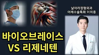 어깨 회전근개파열 패치봉합술 바이오브레이스 vs 리제네텐