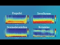 EEG for Anesthesiology - Part 1 Introduction to the EEG for Anesthesiology