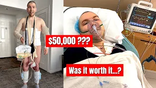 I Paid HOW MUCH for My Plastic Surgery?? (Tummy Tuck, Lipo, Body Lift, Arm & Thigh Lift)