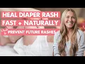 FAST NATURAL Diaper Rash Treatment Every Parent Should Know
