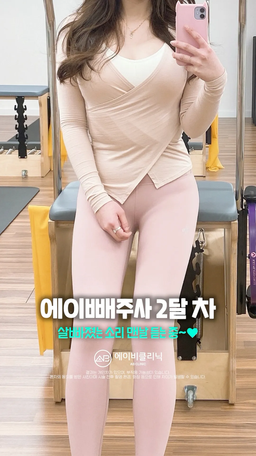 급찐살 쏙 뺀 에이빼주사 후기 💘