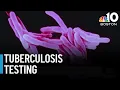 Tuberculosis testing clinic made available after potential exposure in Manchester NH