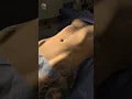 Body Goals Reached Lipo BBL at Vive Plastic Surgery