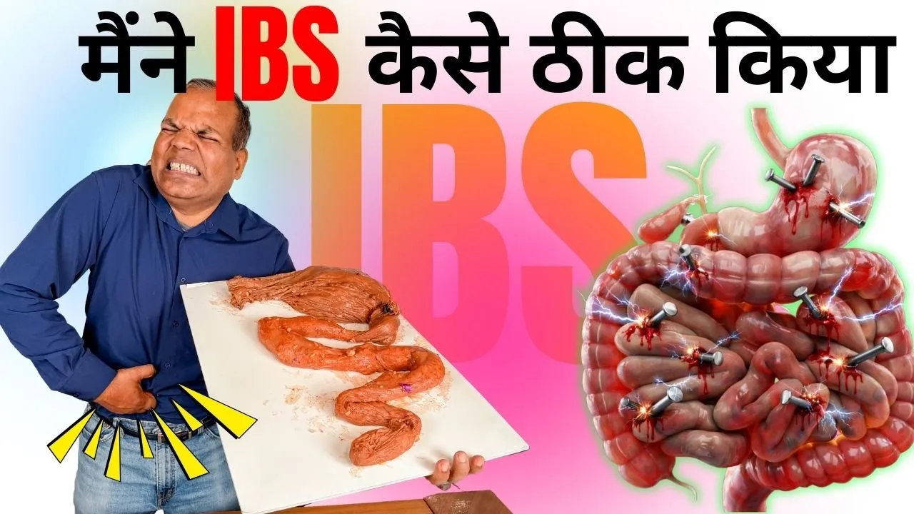 IBS की पूरी जानकारी -Worse Foods for Irritable Bowel Syndrome IBS Dr. Ramesh Chandra