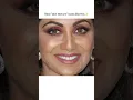 Download Lagu Real skin looks like this😅✨#shorts #bollywood #celebrity #skintexture#fyp