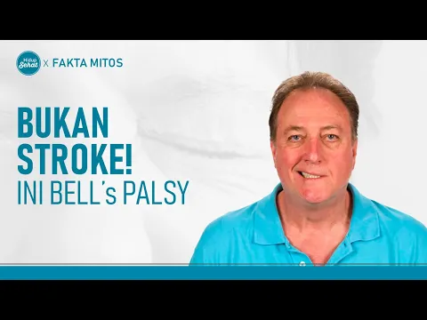 Jangan Keliru! Ini Bedanya Bell's Palsy dengan Stroke