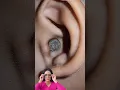 Download Lagu Satisfying relaxing asmr earclining earwax removal