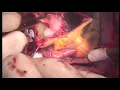 Download Lagu konno operation