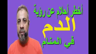 أحلام مهمة عن رؤية الدم في المنام   اسماعيل الجعبيري دندنها