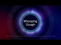 Mayo Clinic Minute - What is whooping cough