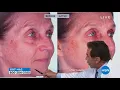 HSN Dr Nassif Skincare 09 06 2018 - 01 PM