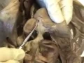 Download Lagu Professor Fink reviews CAT G-I Organs (incl Bile Ducts); Anatomy Dissection