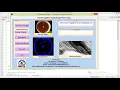 Matlab Code for Iris Recognition System Using Image Processing