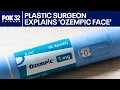 Ozempic face concerns bring 20 patients a week to Chicago plastic surgeon ChicagoNOW