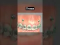 TADs 3 The next level Orthodontic treatment technique