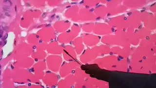 Tecido Muscular