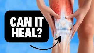 Can the Meniscus Tear in Your Knee Heal On Its Own Knee Cartilage