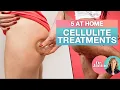 Cellulitis | 5 thuisbehandelingen tegen cellulitis | Dr. J9 Live
