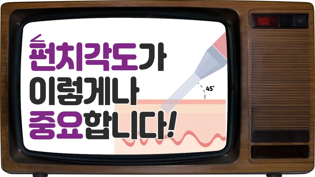 의느님답변📂ㅣ모발이식 수술시 펀치각도가 이렇게나 중요합니다. 여러분!