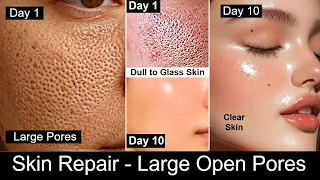 Skin Repair - Close Large Open Pores, Remove DARK SPOTS, Wrinkles and Glowing Skin - Rice Water