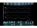 Vent Modes 101 Focus on the Waveform -