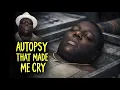The Autopsy of The Notorious B I G The Murder That Silenced a Legend