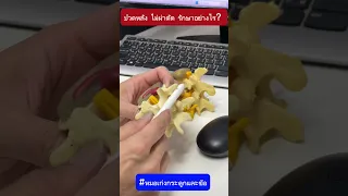  ทำไมถึงเกิดอาการปวดหลังเรื้อรังในผู้ป่วยอายุ 51 ปี 