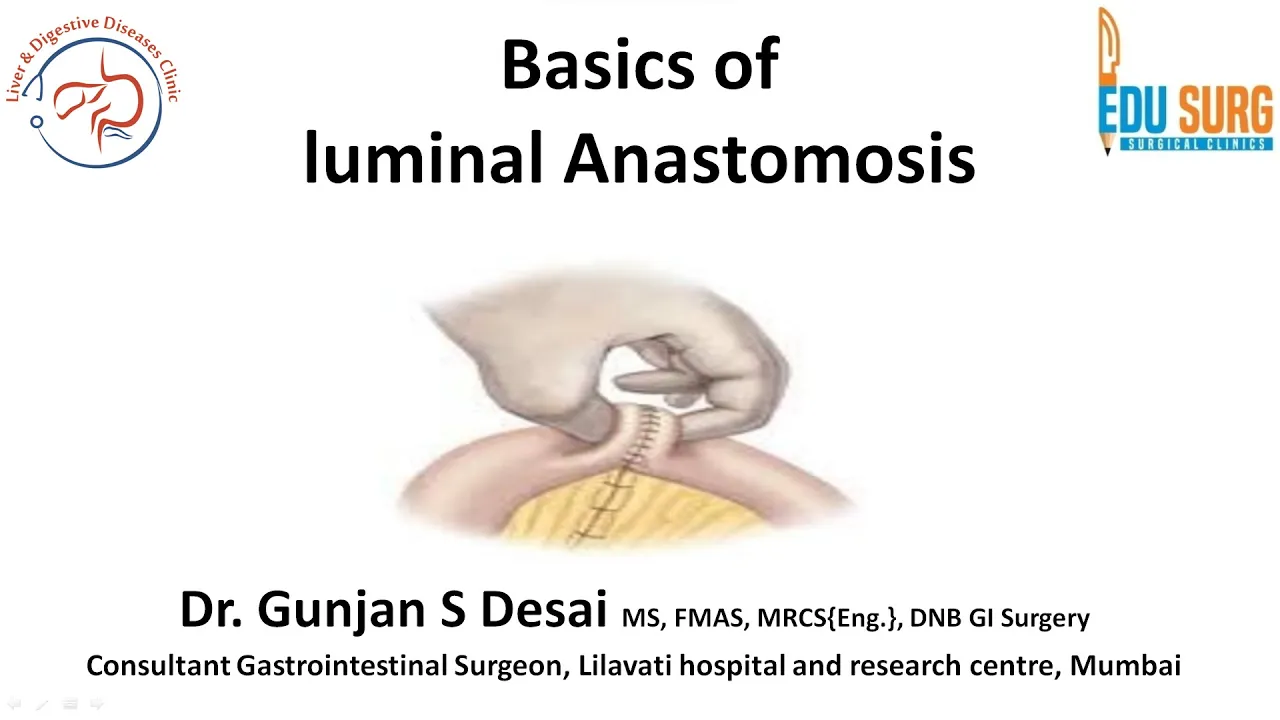 Intestinal anastomosis - layers, nomenclature, phasis of healing, Lembert stitch, and Connell stitch