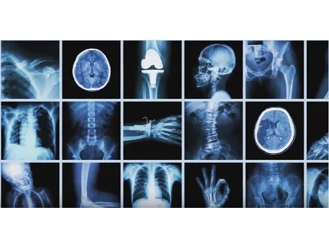 exposure to x ray