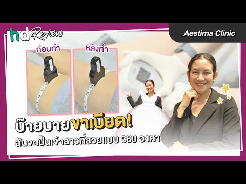 รีวิวสลายไขมันต้นขา โปรแกรม Exilis Ultra 360 ที่ Aestima Clinic (เอสติมาคลินิก)