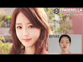 Download Lagu Cinderella Clinic | Gu Yuni's White Swan Journey