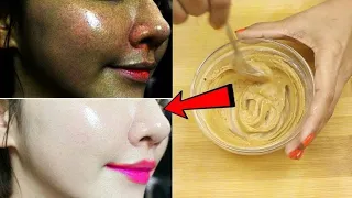 تبييض البشرة من أول استعمال خلطة الحليب والليمون لتفتيح البشرة طريقة استخدام العسل للوجه 